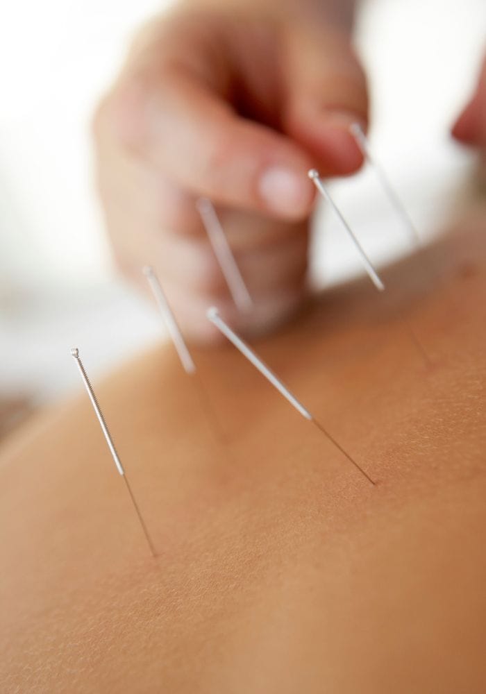Featured image for “Acupuncture for Fertility: A Gentle and Safe Support”